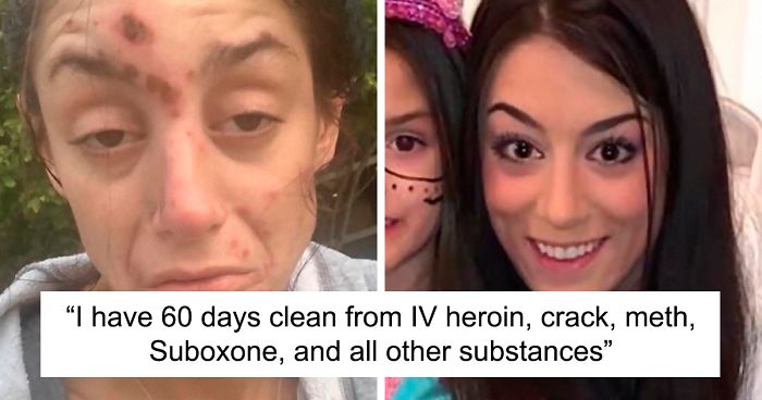 ‘The Addict’s Diary’ Showcases Before & After Transformations Of People ...