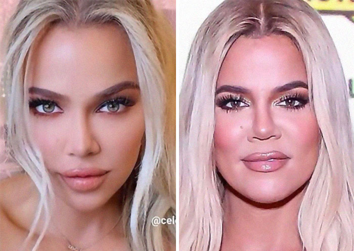 Completely Changed Her Face Structure