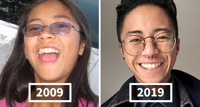 People Are Posting Their Decade Transformations And Here Are 30 Of The Best Ones