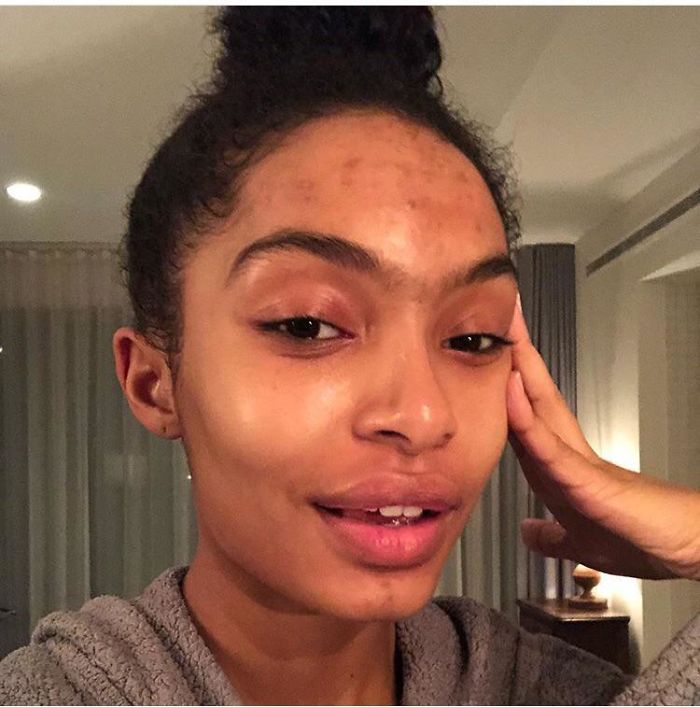 Another Celebrity Showing Natural Skin! Her Feed Keeps It Real