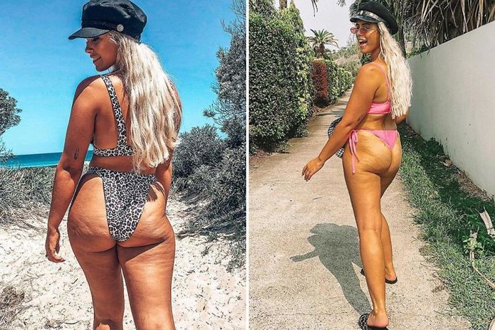 Instagram Model Posting Unedited Pictures Of Herself To Show Body Shaming Is Not Ok.