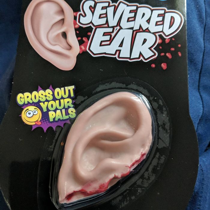 I Was Born Without An Ear. So, For Christmas, My Roommates Got Me This