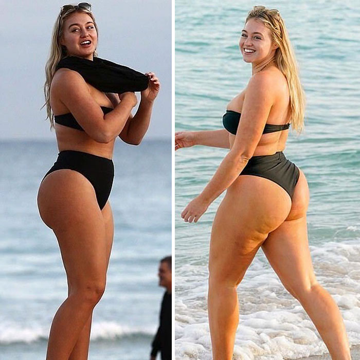 This Model Has Multiple Positive Photos Showing Her 'Real' Body, And Currently Works For The National Eating Disorder Association Due To Experiencing Harsh Unrealistic Pressures During Her Career!