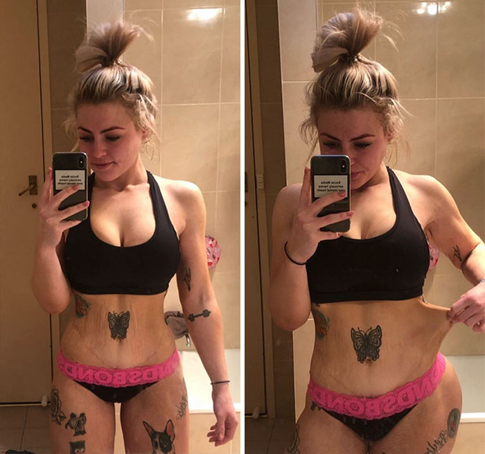 After Extreme Weight Loss, This Influencer Keeps It Real 