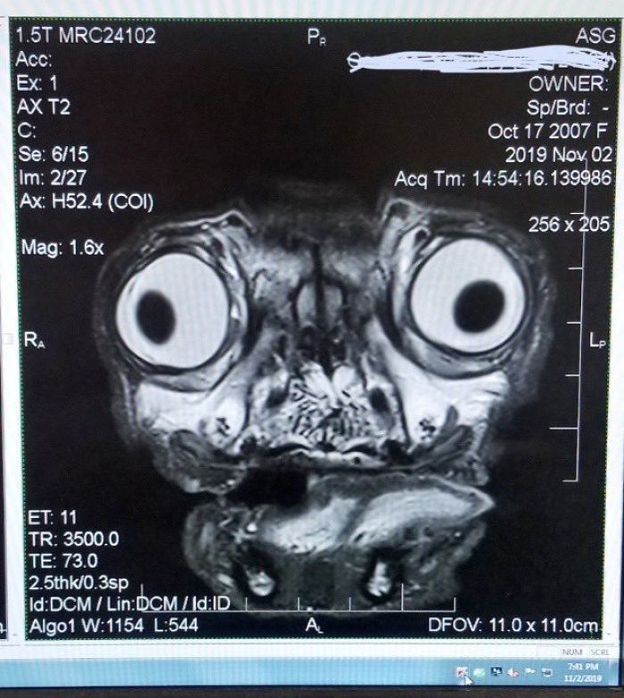Someone Shows What A Pug's MRI Scan Looks Like And It's Pretty Terrifying