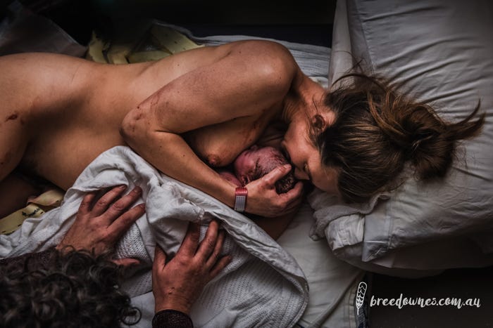 These 16 Award-Winning Photos Capture What It’s Really Like To Give Birth