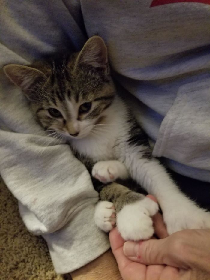 My Mom Adopted This Little Girl And Her Mom. They Both Have Thumbs!