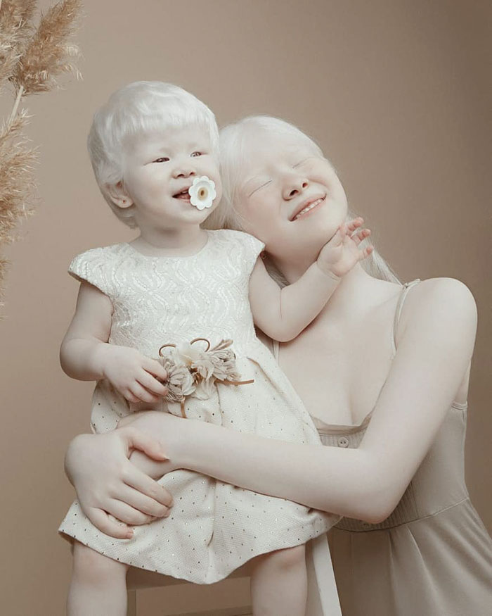Albino Sisters Born 12 Years Apart Stun The World With Their Extraordinary Beauty (24 Pics)