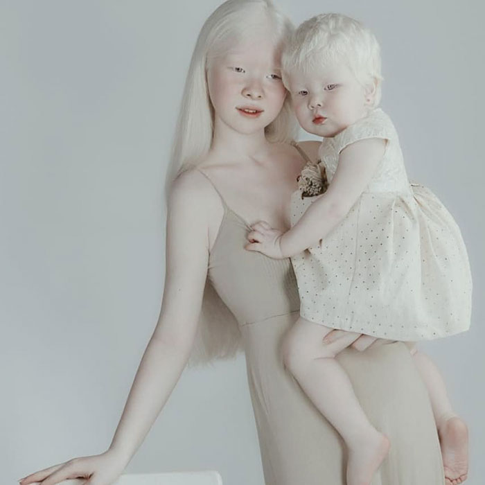 Albino Sisters Born 12 Years Apart Stun The World With Their Extraordinary Beauty (24 Pics)