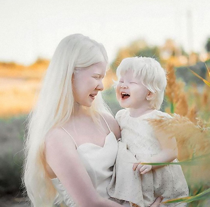 Estas hermanas albinas se llevan 12 años, pero asombran al mundo con su belleza (24 fotos)