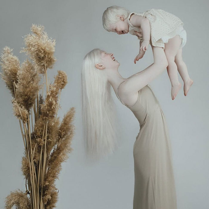 Estas hermanas albinas se llevan 12 años, pero asombran al mundo con su belleza (24 fotos)