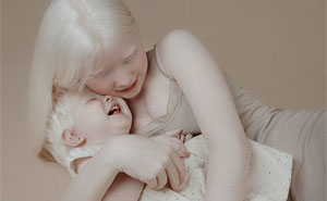 Albino Sisters Born 12 Years Apart Stun The World With Their Extraordinary Beauty (24 Pics)