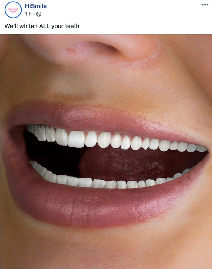 This Ad For Teeth Whitening