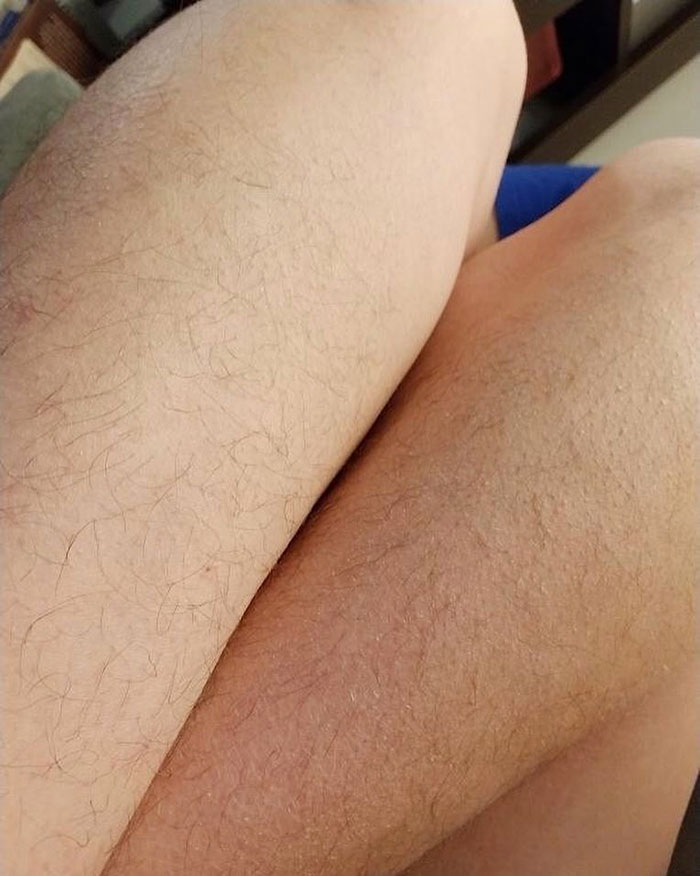 Beautiful Hairy Legs