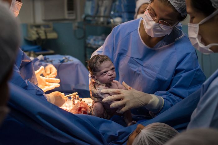 Baby Girl Stares Doctors Down Moments After Being Born, Mom Says She Was ‘Born A Ready Meme’