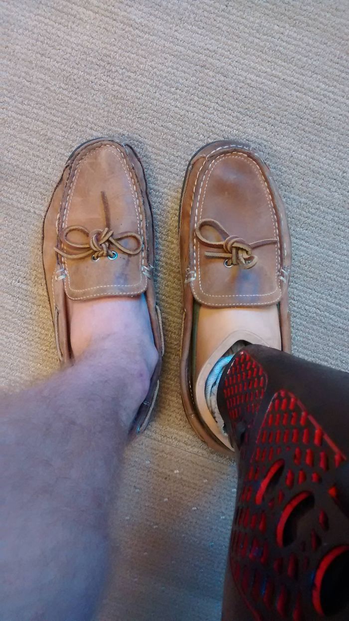 The Difference In Shoe Wear Between My Regular Foot And My Prosthetic Foot After A Year