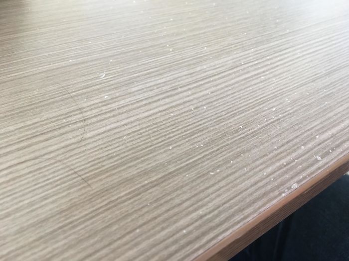 I’m At My University’s Café, A Lady In Front Of Me Was Scratching Her Head And Left Her Dandruff All Over Her Table