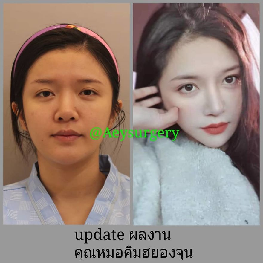 Koreans Are Impressing The Internet With Their Faces After Plastic Surgery