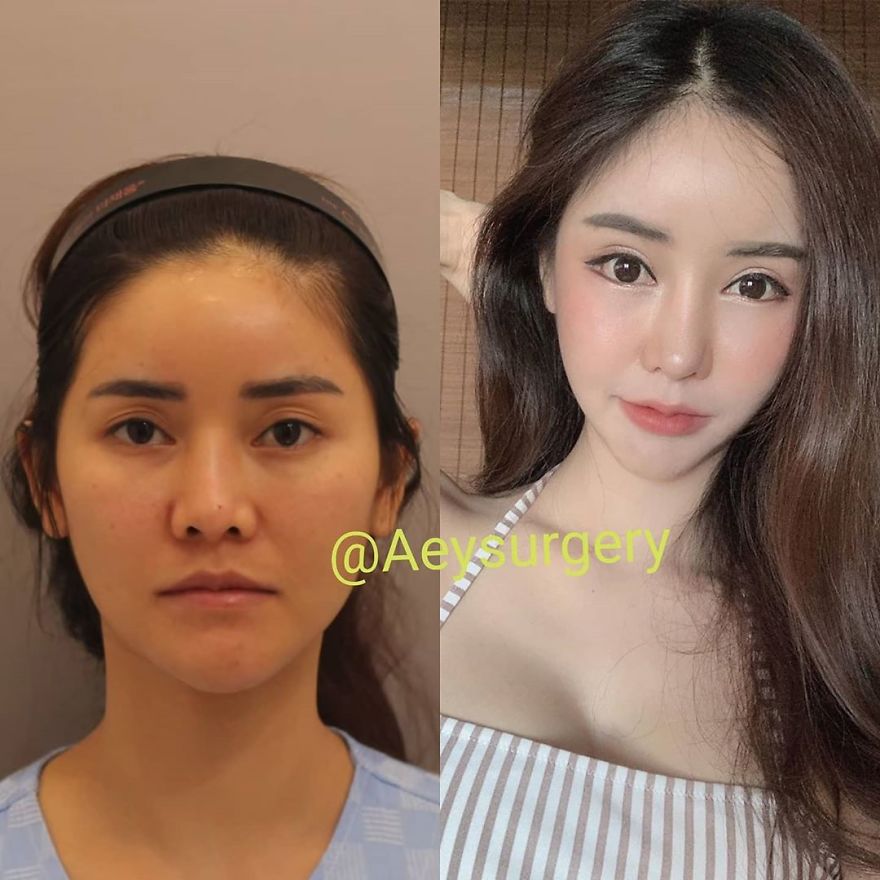 Koreans Are Impressing The Internet With Their Faces After Plastic Surgery