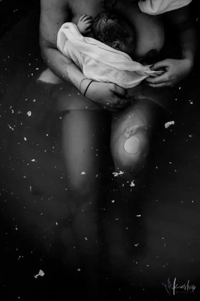 Best In Postpartum: "Vernix Constellation", Kristy Visscher
