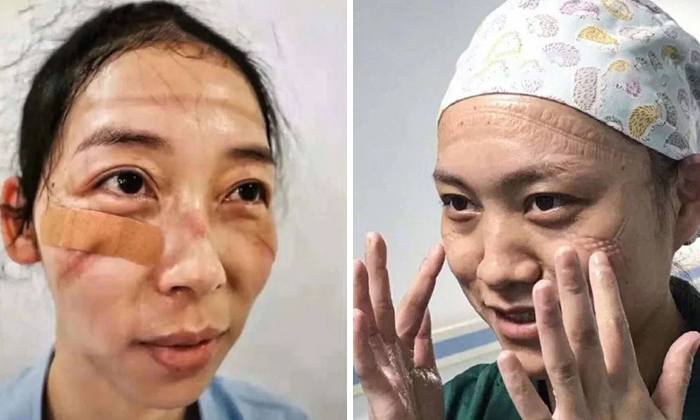 Estas enfermeras chinas muestran sus caras tras pasar incontables horas luchando contra el coronavirus