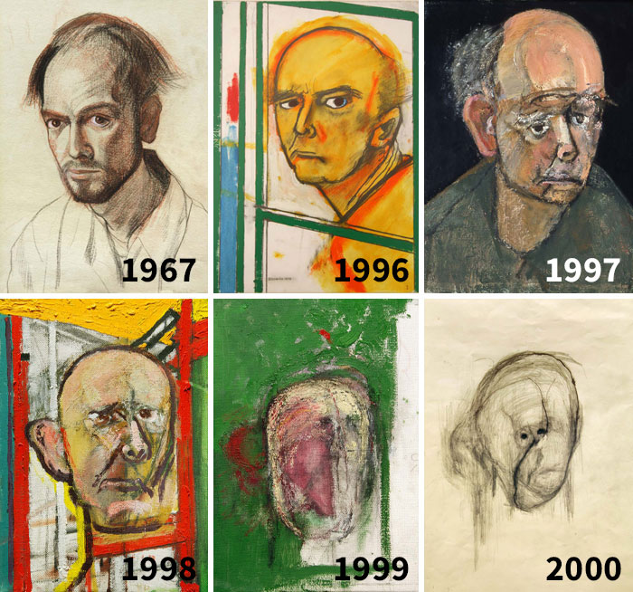 William Utermohlen fue diagnosticado con Alzheimer. Estuvo pintando su autorretrato hasta que no pudo reconocer su propia cara