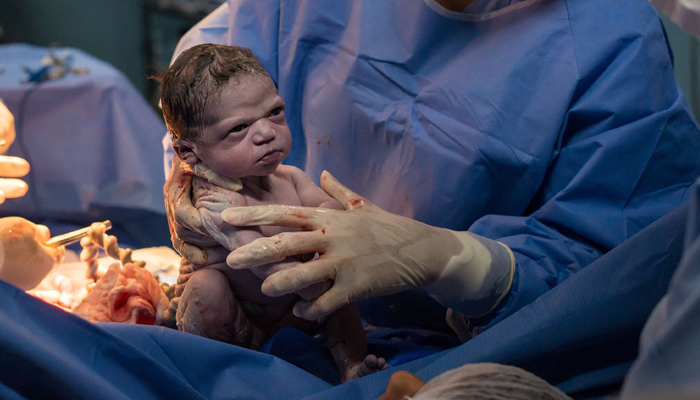 Baby Girl Stares Doctors Down Moments After Being Born, Mom Says She Was ‘Born A Ready Meme’