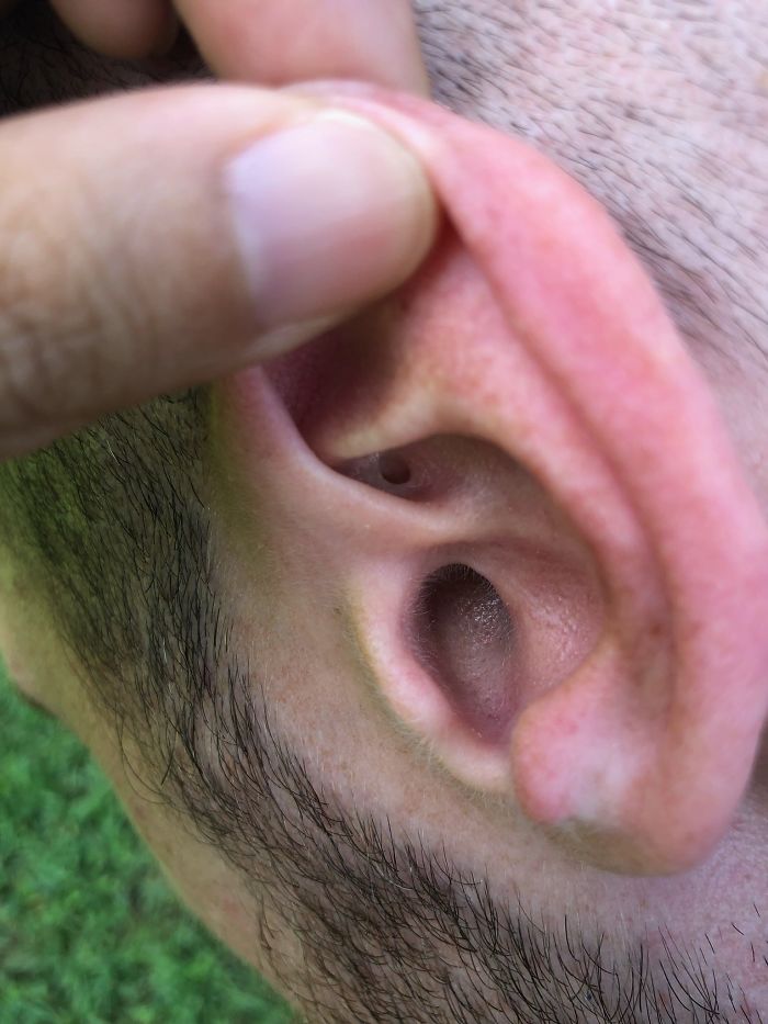 Tengo un agujero extra en la oreja