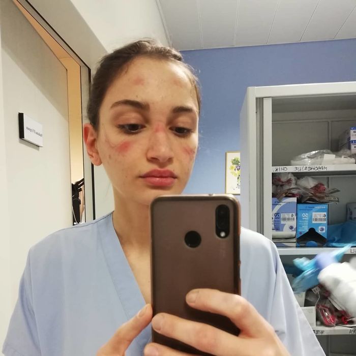 Nurse Treating Coronavirus Patients In Italy Shares How Hard It Is With A Heartbreaking Pic