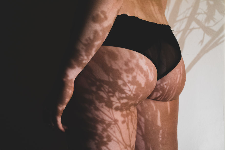 I've Photographed Women's Bodies To Show Them That Their "Complexes" Are Beautiful