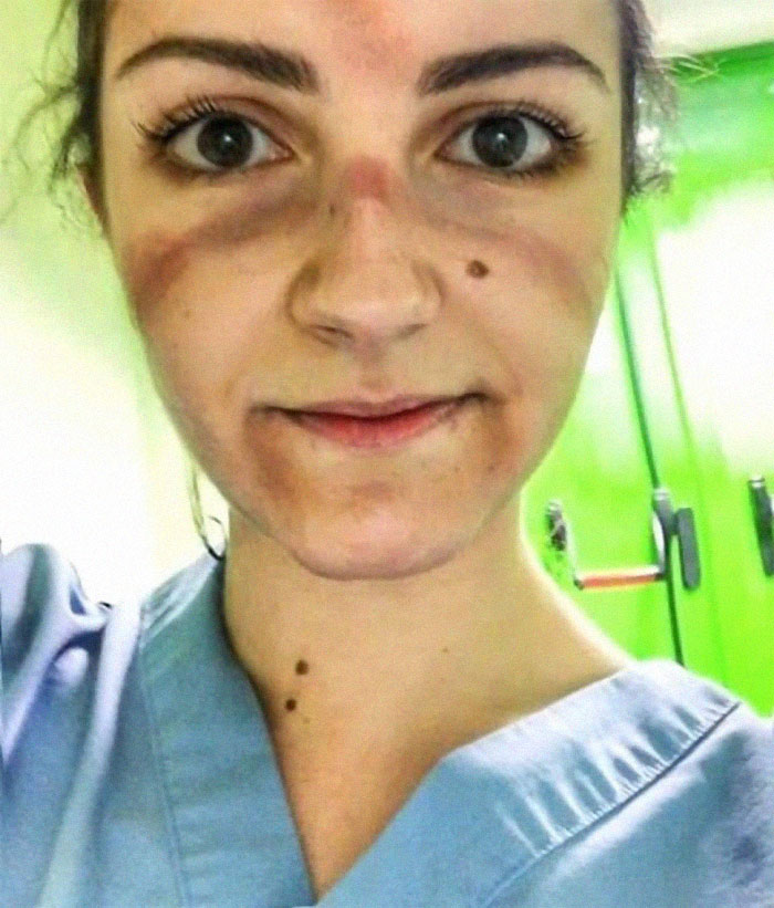 Nurse After Hours Of Work In Intensive Care