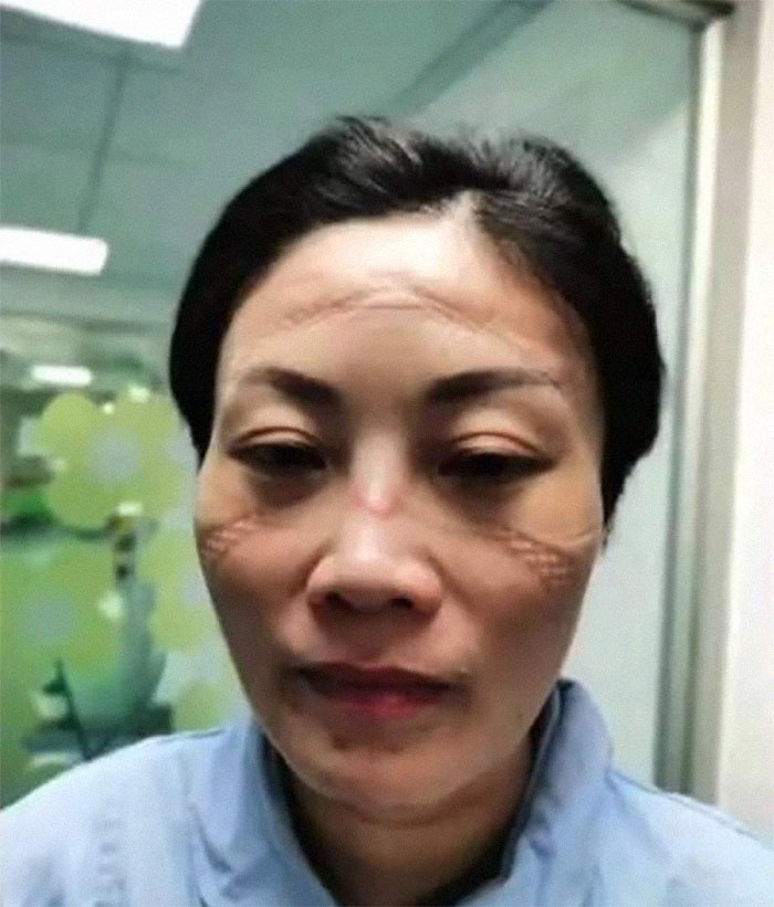 Nurse's Face After A Long Shift