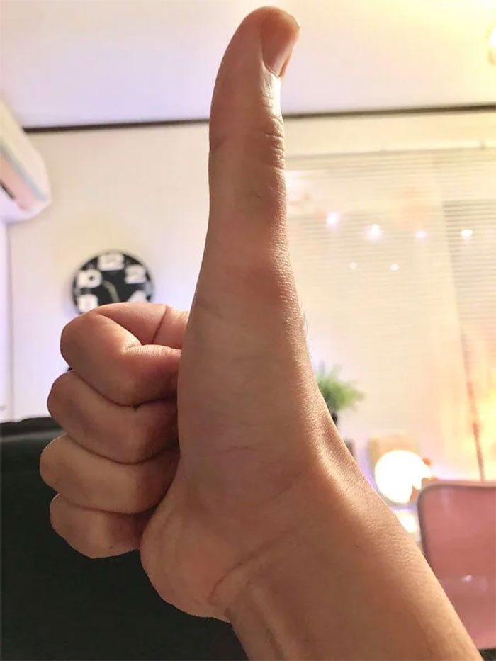 I Think My Thumb Is A Bit Too Big