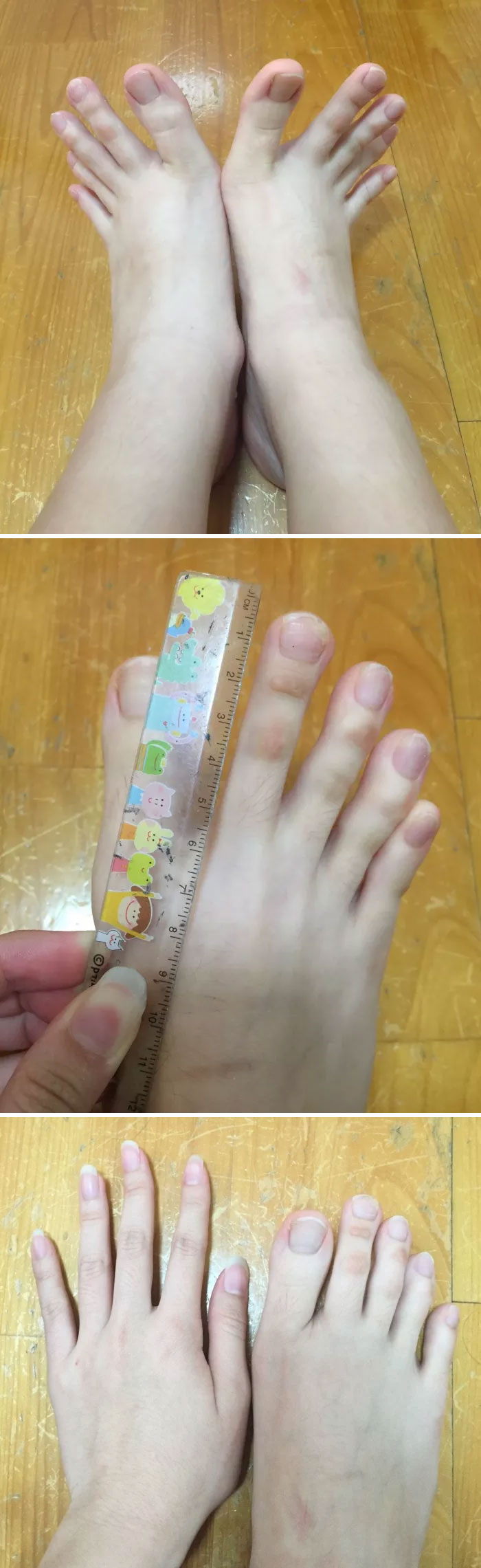 My Height Is Not High, Only 151cm, But My Toes Are Inexplicably Long