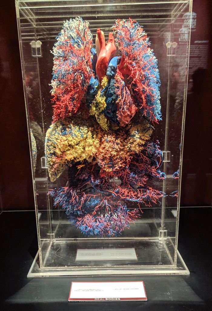 Respiratory System From A Local Exhibition