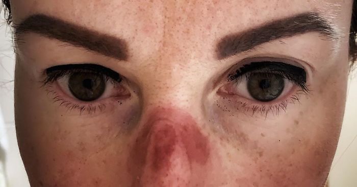 A Czech Nurse Shares What Her Face Looks Like After Working At A Hospital