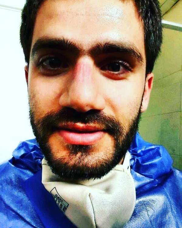 Medical Worker Shares His Bruised Face After A Long Shift In Iran At The Tehran Hajar Hospital