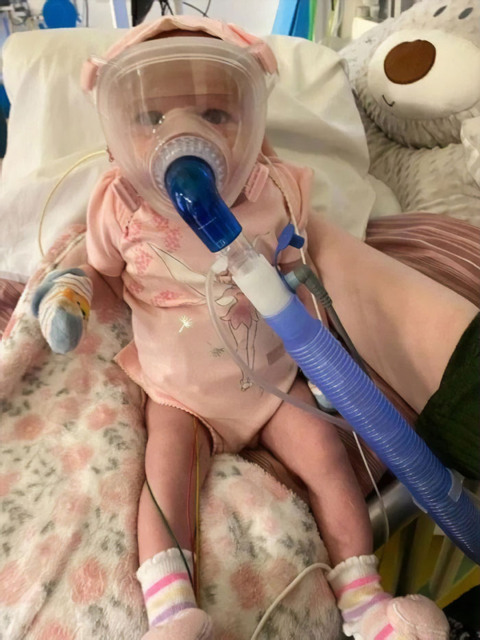 6-Month-Old Baby Survives Coronavirus After Fighting Heart Conditions And Lung Problems