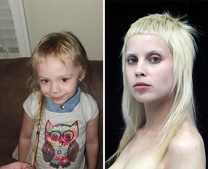 My Daughter Found Scissors And Cut Her Hair. Now She Looks Like Yolandi