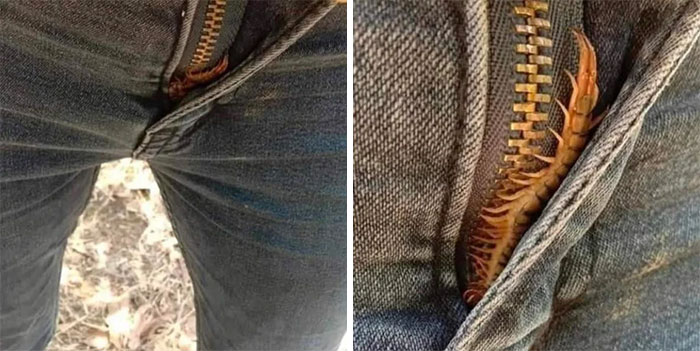 This Guy Found A Centipede On His Zipper