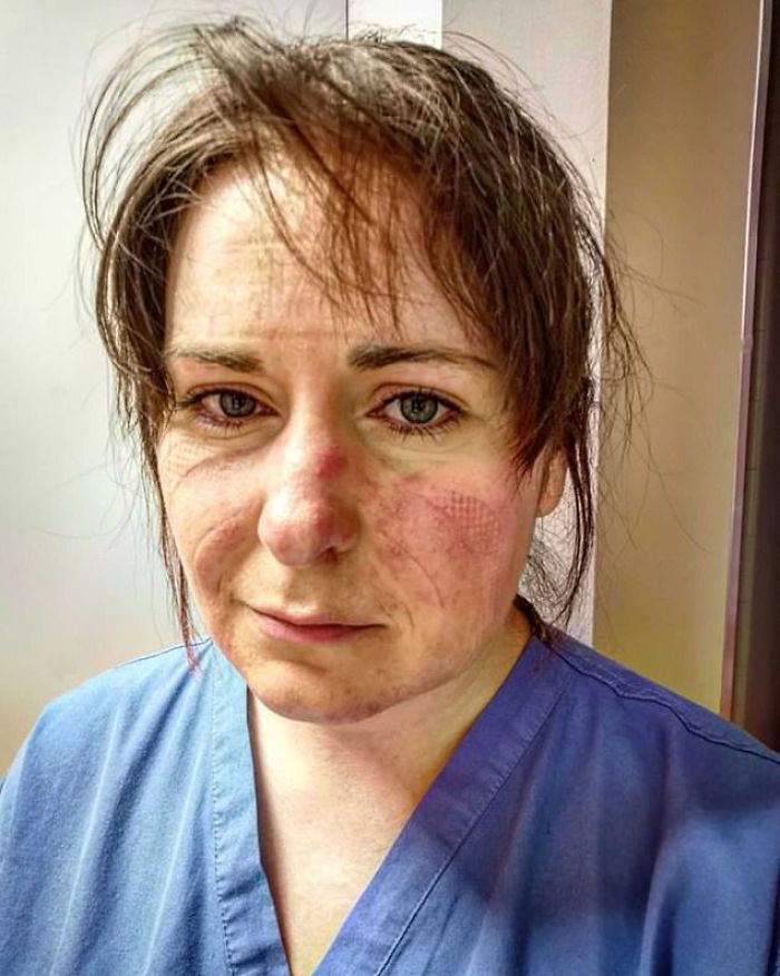 „To je tvár sestry ICU. Je to tvár práce 65 hodín za posledných šesť dní.“