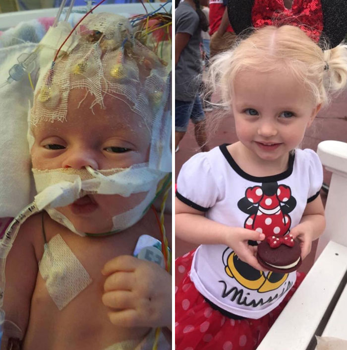 Doctors Told Us To Make Preparations For Losing Her, But After 5 Brain Surgeries My Baby Had Her First Disney Trip At 3 Years Old