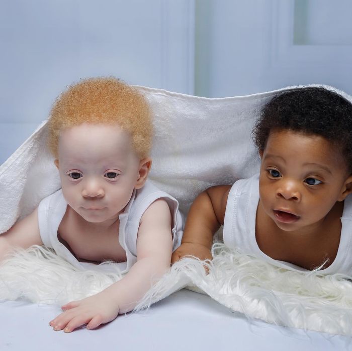 Mom Of Black And White Twins Often Gets Asked Which One Of The Boys Is Hers
