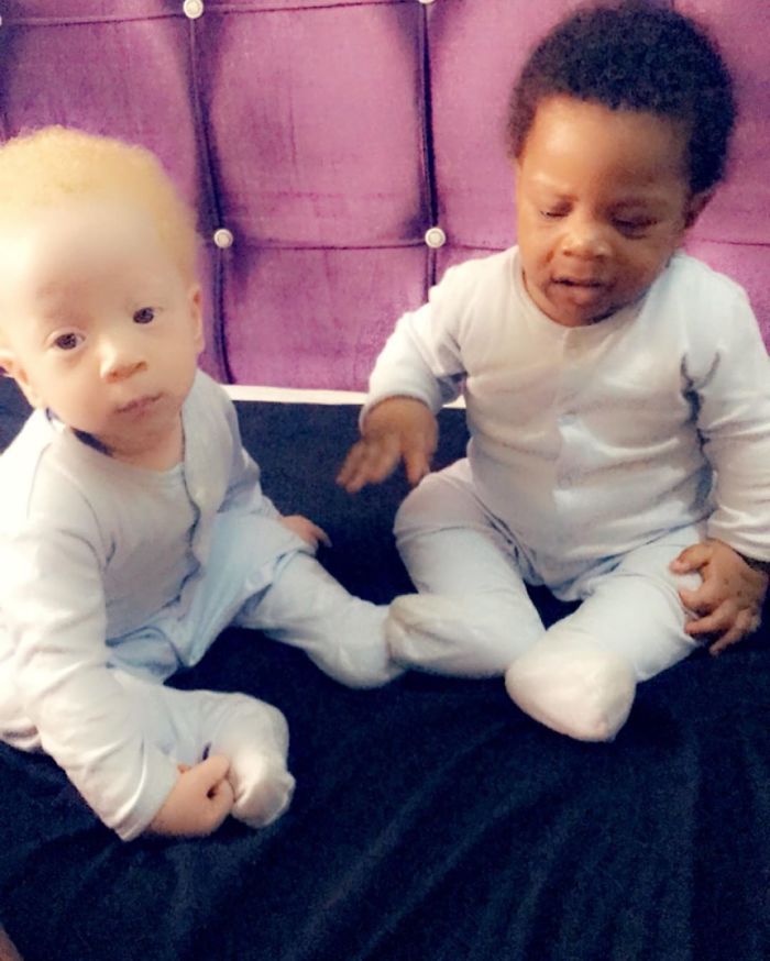 Mom Of Black And White Twins Often Gets Asked Which One Of The Boys Is Hers