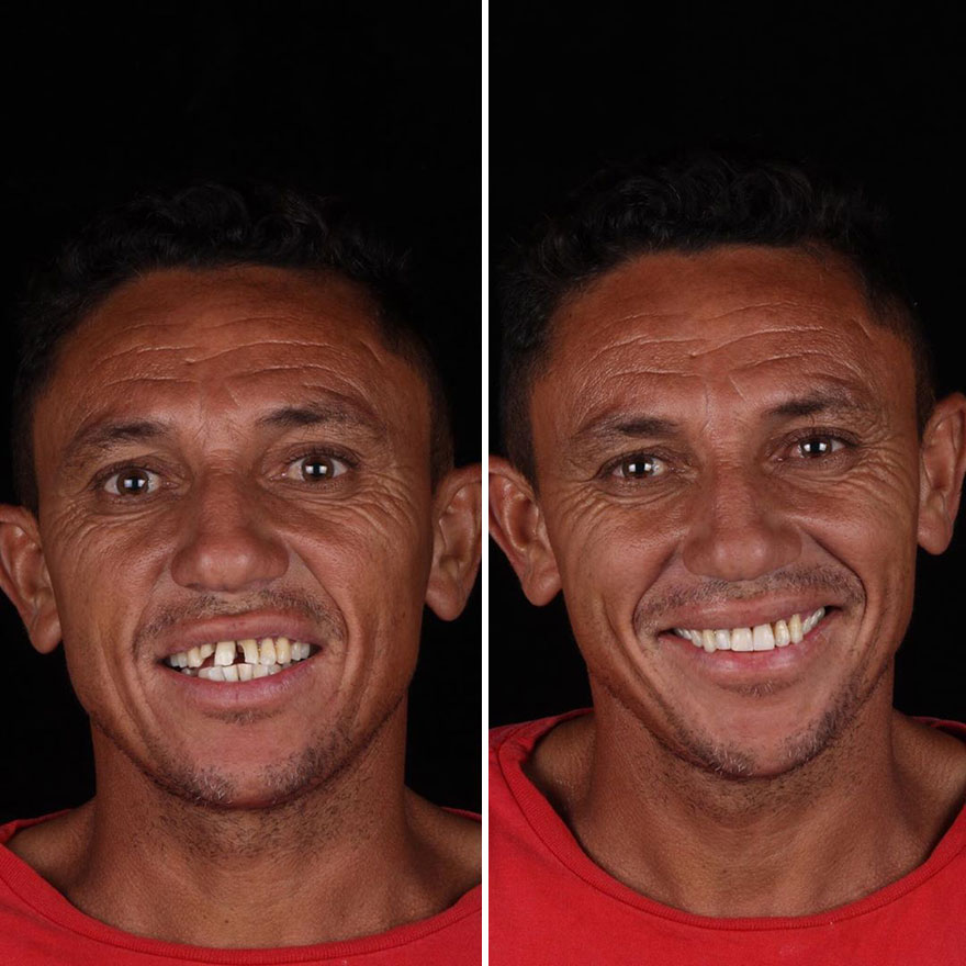 Brazilian Dentist Continues To Travel The World Spreading Smiles To Needy People