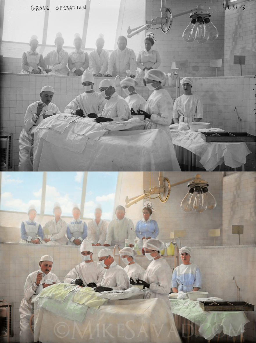 Colorized Medical Pictures (14 Pictures)