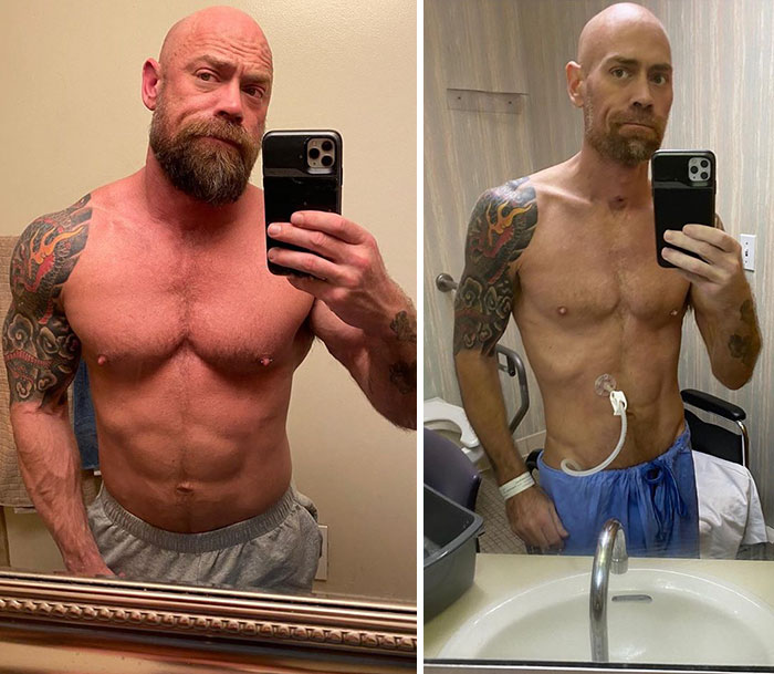 Man Shares An Eye-Opening Pic Showing What Covid-19 Did To Him After 6 Weeks In A Hospital