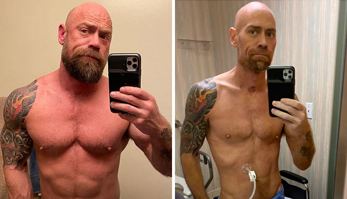 Man Shares An Eye-Opening Pic Showing What Covid-19 Did To Him After 6 Weeks In A Hospital