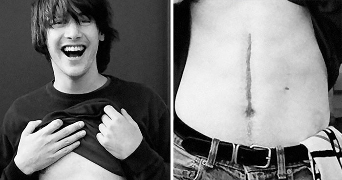 26 Celebrities That Have Visible Scars And The Stories Behind Them
