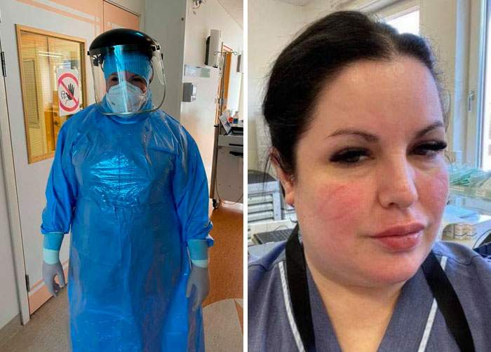 “Damn Covid-19. You Took The Wrong Girl” Swedish Nurse Passes Away 4 Days Later After Testing Positive For Coronavirus